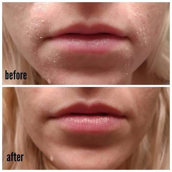 CeraVe Moisturizing Cream